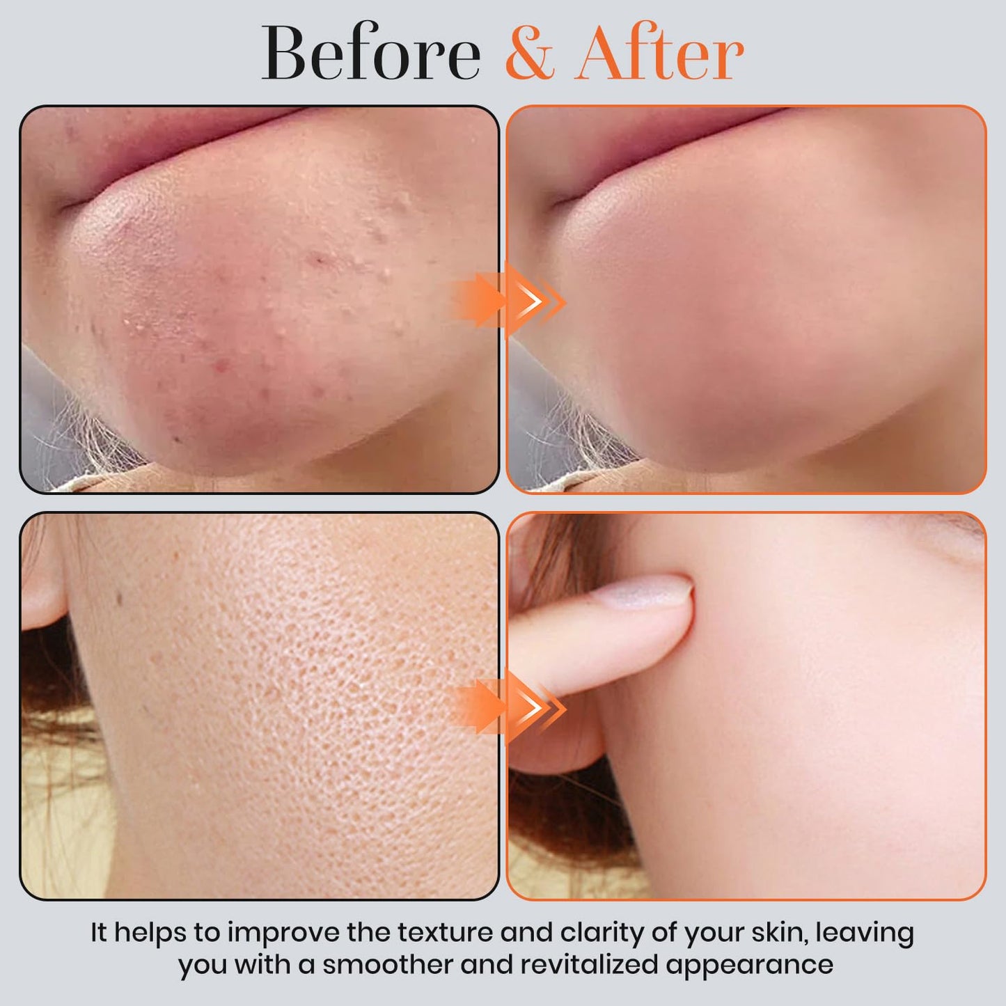 🍊 Wash Away Dull, Rough Skin — Buy 1 Get 1 FREE Today  Citrus enzymes. No scrubbing. Visible glow in days.